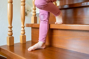 Как крепить балясины к ступеням, полу и перилам: выбор крепежа и пошаговая инструкция